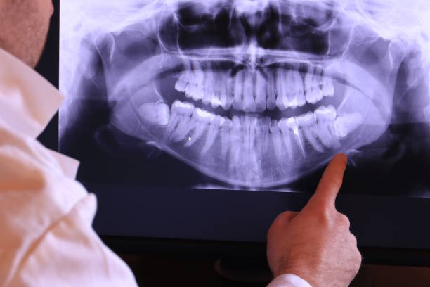 Fast & Reliable Emergency Dental Services in WY