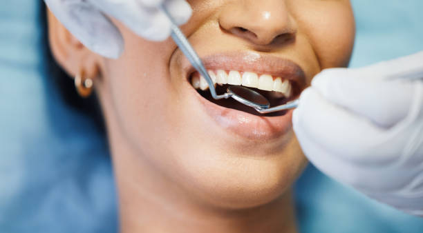 Best Emergency Tooth Extraction in Glenrock, WY