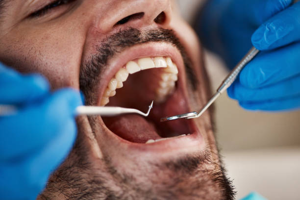 Best Same-Day Emergency Dental Services in Glenrock, WY