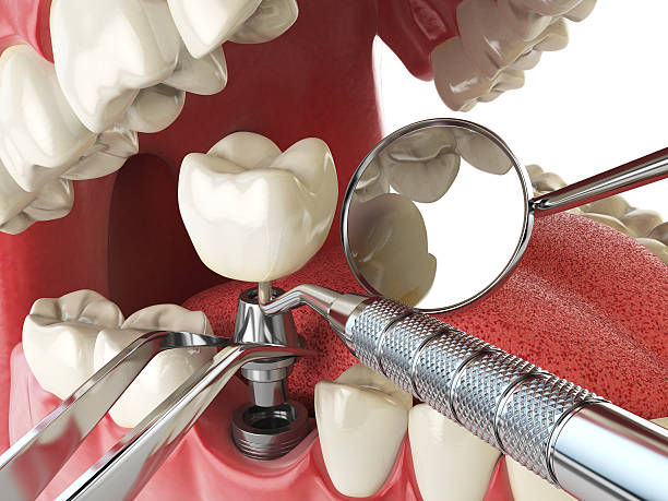 Best Cosmetic Emergency Dentistry in Glenrock, WY